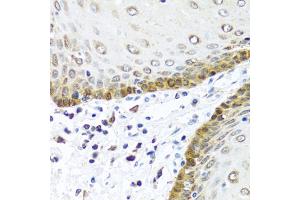 Immunohistochemistry of paraffin-embedded human esophagus using BMP5 antibody. (BMP5 anticorps)
