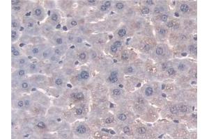 Detection of NAT1 in Mouse Liver Tissue using Polyclonal Antibody to N-Acetyltransferase 1 (NAT1)