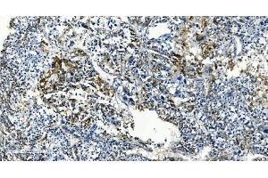 IHC analysis of TMBIM1 using anti-TMBIM1 antibody (ABIN7603190). (TMBIM1 anticorps  (N-Term))