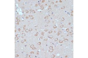 Immunohistochemistry of paraffin-embedded mouse brain using COPG2 antibody (ABIN7266426) at dilution of 1:100 (40x lens). (COPG2 anticorps  (AA 542-871))
