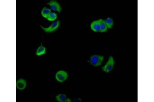 Immunofluorescence staining of MCF-7 cells with ABIN7161114 at 1:133, counter-stained with DAPI. (PVRL4 anticorps  (AA 91-199))
