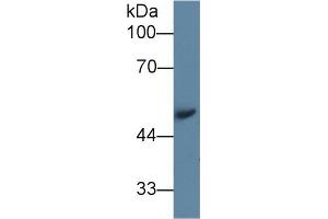 Detection of AGT in Mouse Serum using Polyclonal Antibody to Angiotensinogen (AGT)