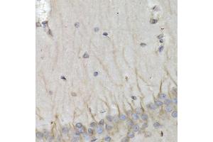 Immunohistochemistry of paraffin-embedded rat brain using PSMB10 antibody (ABIN6132527, ABIN6146311, ABIN6146312 and ABIN6221107) at dilution of 1:200 (40x lens).