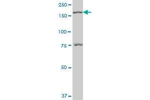 LMTK3 polyclonal antibody (A01), Lot # 060525JCS1 Western Blot analysis of LMTK3 expression in Hela S3 NE .
