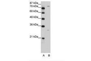 Image no. 2 for anti-Prostaglandin-Endoperoxide Synthase 1 (Prostaglandin G/H Synthase and Cyclooxygenase) (PTGS1) (AA 51-100) antibody (ABIN203401) (PTGS1 anticorps  (AA 51-100))