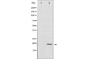 Western blot analysis of Stathmin 1 phosphorylation expression in PMA treated Jurkat whole cell lysates,The lane on the left is treated with the antigen-specific peptide. (Stathmin 1 anticorps  (pSer25))