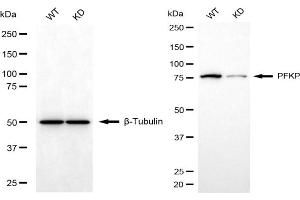 Western blotting analysis using PFKP antibody (ABIN7799803). (PFKP anticorps)