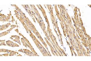 Detection of AST in Mouse Cardiac Muscle Tissue using Monoclonal Antibody to Aspartate Aminotransferase (AST) (GOT1 anticorps  (AA 1-413))
