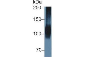 Detection of ATP1a1 in Porcine Cerebrum lysate using Polyclonal Antibody to ATPase, Na+/K+ Transporting Alpha 1 Polypeptide (ATP1a1) (ATP1A1 anticorps  (AA 493-660))