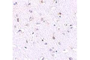 Immunohistochemical staining of human brain tissue with 2. (Nanos Homolog 1 anticorps  (N-Term))