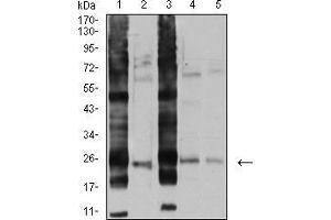 Western blot analysis using RALB mouse mAb against A549 (1), U251 (2), HT-29 (3), HEK293 (4), and LOVO (5) cell lysate. (RALB anticorps  (AA 89-206))