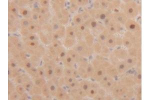Detection of PCNA in Human Liver Tissue using Polyclonal Antibody to Proliferating Cell Nuclear Antigen (PCNA) (PCNA anticorps  (AA 6-261))