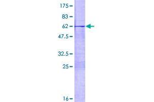 Image no. 1 for Msh Homeobox 1 (MSX1) (AA 1-297) protein (GST tag) (ABIN1311491)