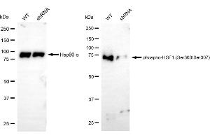 Western blotting analysis using phospho-HSF1 (Ser303/Ser307) antibody (ABIN7798864).