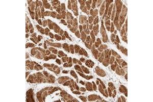 Immunohistochemical staining of human heart muscle with TRIM11 polyclonal antibody  shows strong cytoplasmic positivity in myocytes at 1:20-1:50 dilution. (TRIM11 anticorps)