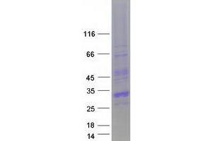 Validation with Western Blot