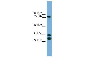 Western Blot showing DNAI2 antibody used at a concentration of 1-2 ug/ml to detect its target protein. (DNAI2 anticorps  (N-Term))