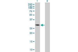 Western Blot analysis of SIP1 expression in transfected 293T cell line by SIP1 MaxPab polyclonal antibody.