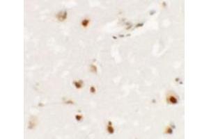 Immunohistochemistry of SHANK3 in human brain tissue with SHANK3 antibody at 2.