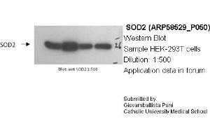 Western Blotting (WB) image for anti-Superoxide Dismutase 2, Mitochondrial (SOD2) (N-Term) antibody (ABIN2787727) (SOD2 anticorps  (N-Term))