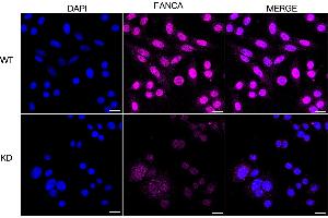 Immunocytochemical staining of HepG2 cells using FANCA antibody (ABIN7798563), 1:1,000), Top panel: wild-type (WT), Bottom panal: FANCA shRNA knockdown (KD).