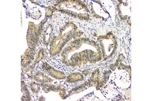 IHC analysis of EIF6 using anti-EIF6 antibody (ABIN6719594).