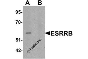 Western Blotting (WB) image for anti-Estrogen-Related Receptor beta (ESRRB) (N-Term) antibody (ABIN1031374) (ESRRB anticorps  (N-Term))