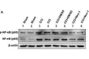 Necrostatin-1 attenuated neuroinflammatory changes in a rat neuropathic pain model.