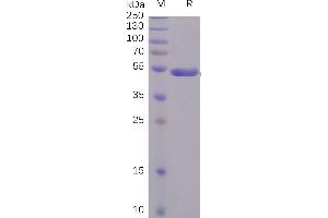 SARS-CoV-2 (2019-nCoV) S1 protein CTD, hFc Tag on SDS-PAGE under reducing condition.