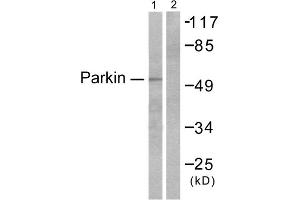 Western blot analysis of extracts from Jukat cells, using Parkin antibody (ABIN5976483). (Parkin anticorps  (N-Term))