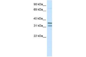 WB Suggested Anti-NKX2-2 Antibody Titration:  0. (Nkx2-2 anticorps  (N-Term))