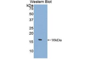 Western Blotting (WB) image for anti-Tryptase delta 1 (TPSD1) (AA 99-191) antibody (ABIN1860851) (TPSD1 anticorps  (AA 99-191))