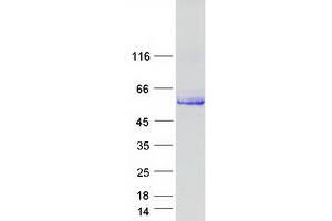 Validation with Western Blot
