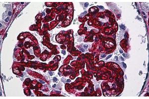 Human Kidney, Glomeruli: Formalin-Fixed, Paraffin-Embedded (FFPE) (CD34 anticorps)