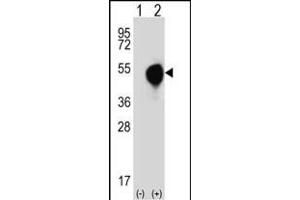 Western blot analysis of DOM3Z (arrow) using rabbit polyclonal DOM3Z Antibody (N-term Y88) (ABIN390574 and ABIN2840900).