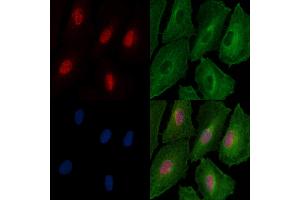Phospho-FOXL2 (Ser263) Antibody staining A549 cells(4h of LPS treatment) by IF/ICC. (FOXL2 anticorps  (pSer263))