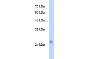 WB Suggested Anti-MRPS15 Antibody Titration:  2. (MRPS15 anticorps  (C-Term))