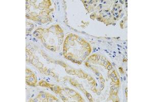 Immunohistochemistry of paraffin-embedded human kidney using ABCC1 Antibody.