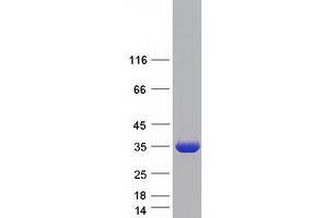 Validation with Western Blot