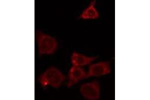 ABIN6266628 staining HeLa by IF/ICC. (RASH/RASK/RASN anticorps)