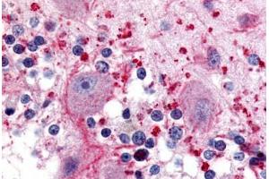 Human Brain, Cerebellum (formalin-fixed, paraffin-embedded) stained with HTR5A antibody ABIN213518 at 10 ug/ml followed by biotinylated goat anti-rabbit IgG secondary antibody ABIN481713, alkaline phosphatase-streptavidin and chromogen.