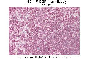 Image no. 1 for anti-E2F Transcription Factor 1 (E2F1) (Internal Region), (Lys120) antibody (ABIN571306) (E2F1 anticorps  (Internal Region, Lys120))