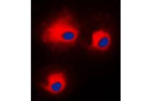 Immunofluorescent analysis of PKC theta (pS676) staining in HeLa cells. (PKC theta anticorps  (C-Term, pSer676))