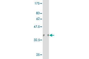 Western Blot detection against Immunogen (36. (HIPK1 anticorps  (AA 330-430))