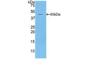 Detection of Recombinant MUC1, Mouse using Polyclonal Antibody to Mucin 1 (MUC1)