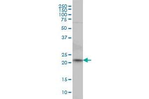 NKIRAS2 monoclonal antibody (M02), clone 2G9 Western Blot analysis of NKIRAS2 expression in HeLa .