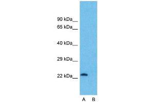Host:  Rabbit  Target Name:  ATF3  Sample Type:  OVCAR-3  Lane A:  Primary Antibody  Lane B:  Primary Antibody + Blocking Peptide  Primary Antibody Concentration:  1ug/ml  Peptide Concentration:  5ug/ml  Lysate Quantity:  25ug/lane/lane  Gel Concentration:  0. (ATF3 anticorps  (Middle Region))