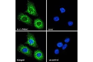 (ABIN190847) Immunofluorescence analysis of paraformaldehyde fixed A431 cells, permeabilized with 0.
