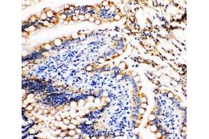 IHC-P: Vinculin antibody testing of rat intestine tissue (Vinculin anticorps  (AA 173-188))