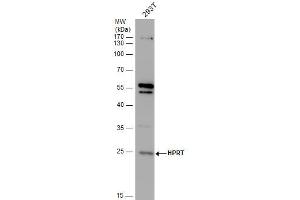 WB Image HPRT antibody detects HPRT protein by western blot analysis. (HPRT1 anticorps)